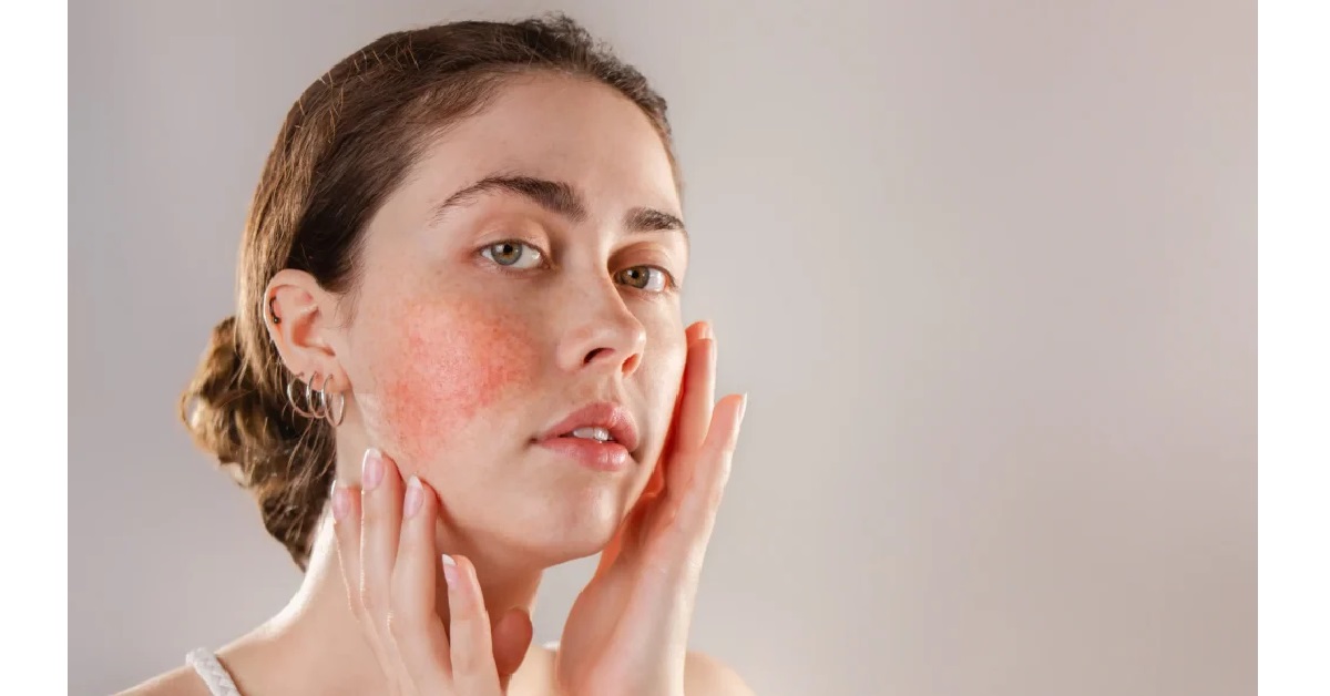 نشانه‌های پوست حساس چیست؟