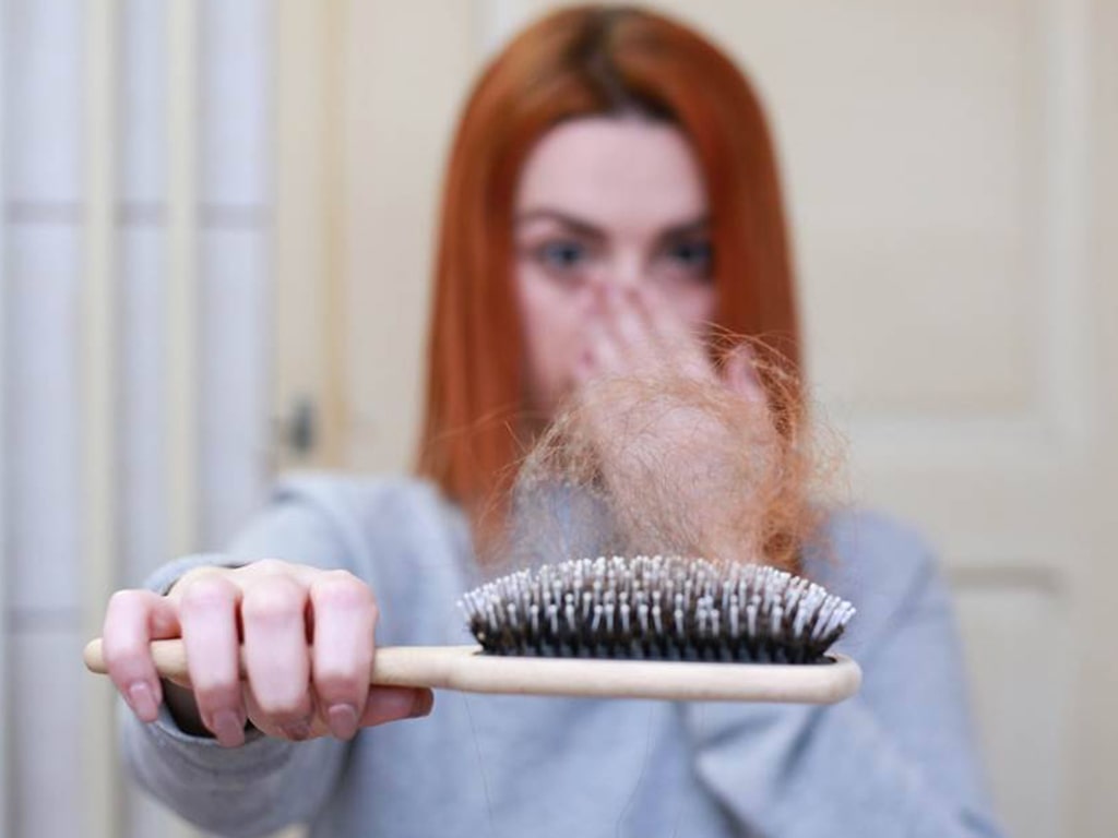 آلوپسی آندروژنتیک علت ریزش مو در زنان
