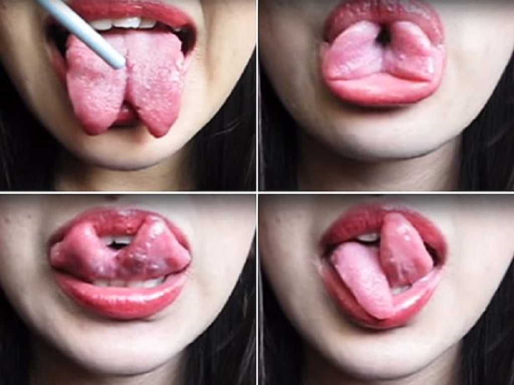 جراحی نصف کردن زبان