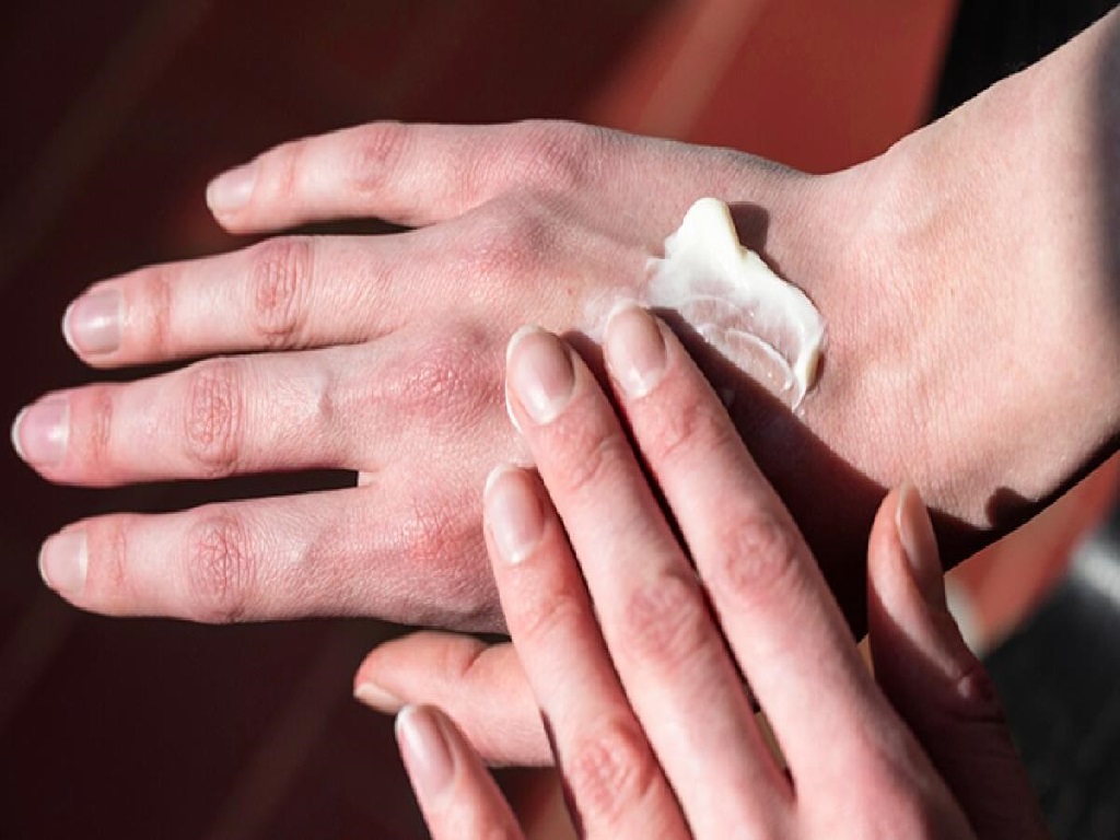 کرم و پماد جهت درمان خشکی پوست دست