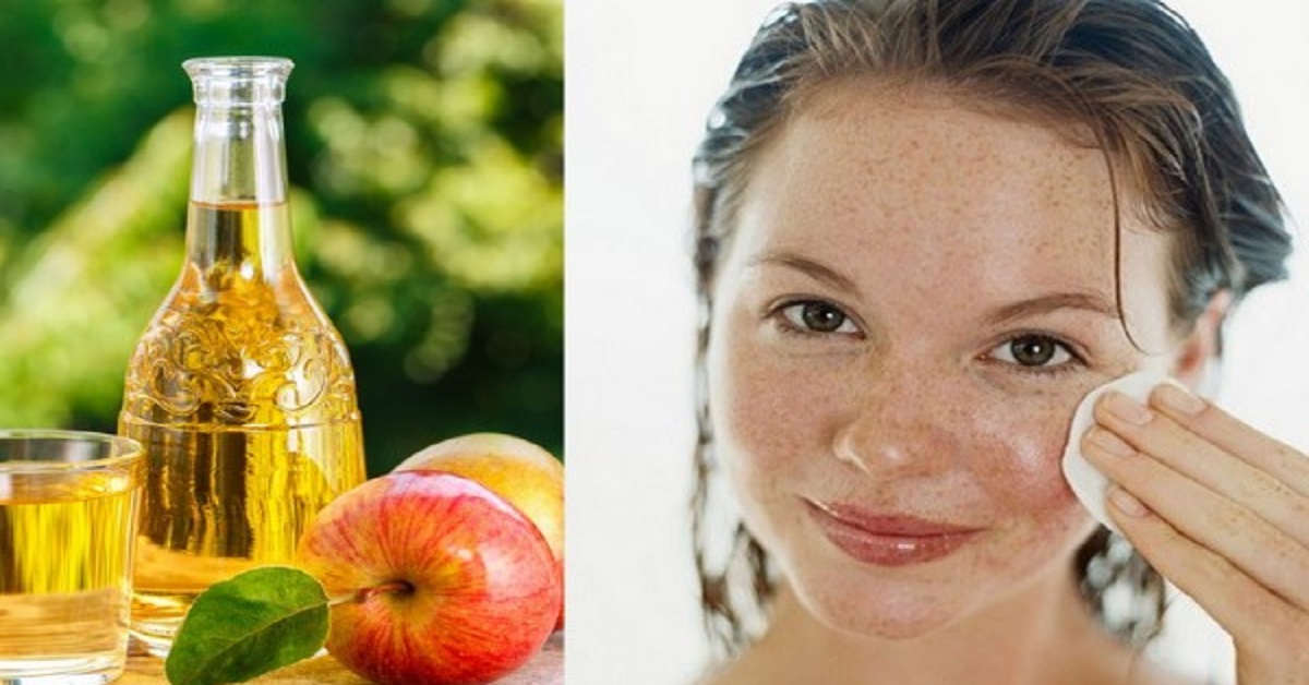 استفاده از سرکه سیب برای درمان جای جوش