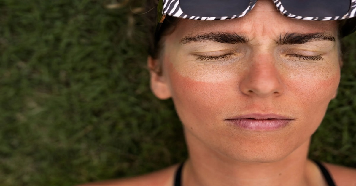 افزایش خطر آفتاب‌سوختگی با مصرف راکوتان