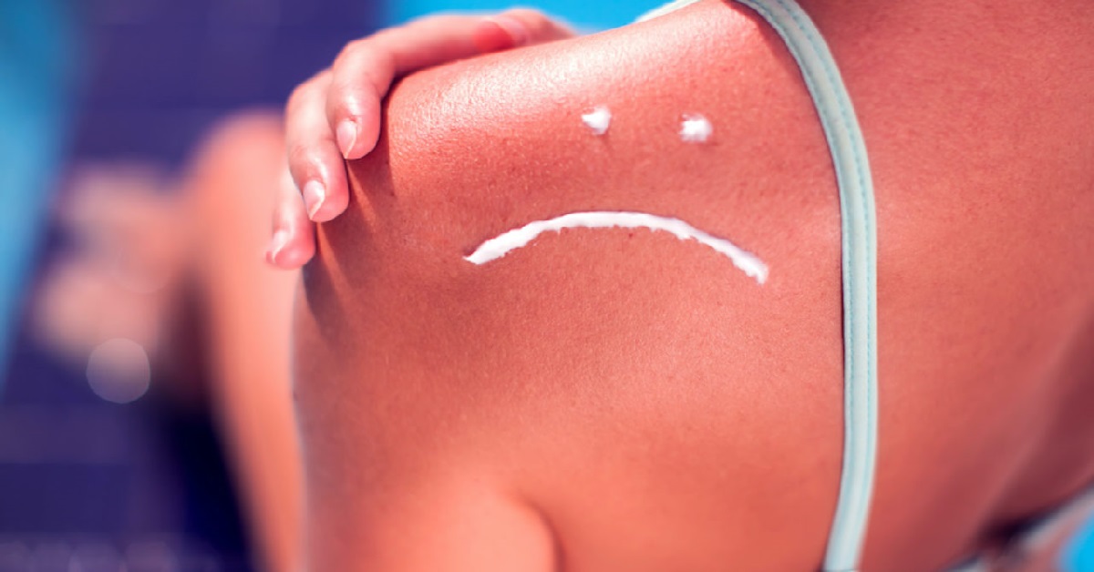 کاهش خطر آفتاب‌سوختگی با گوجه‌فرنگی