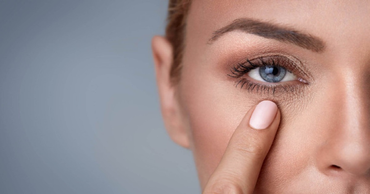 استفاده از کرم‌های موضعی جهت درمان پف و سیاهی دور چشم