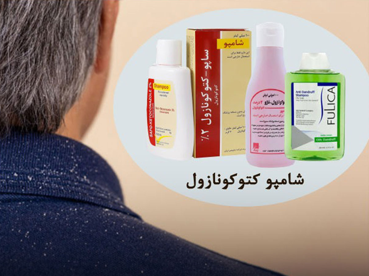 cetoconazol shampoo 2 - شامپو کتوکونازول برای ریزش مو حقیقت یا تبلیغ؟