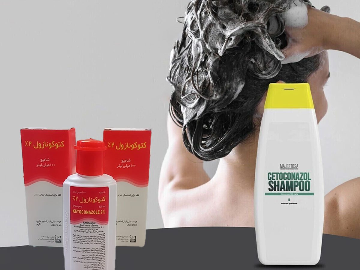 cetoconazol shampoo 5 - شامپو کتوکونازول برای ریزش مو حقیقت یا تبلیغ؟
